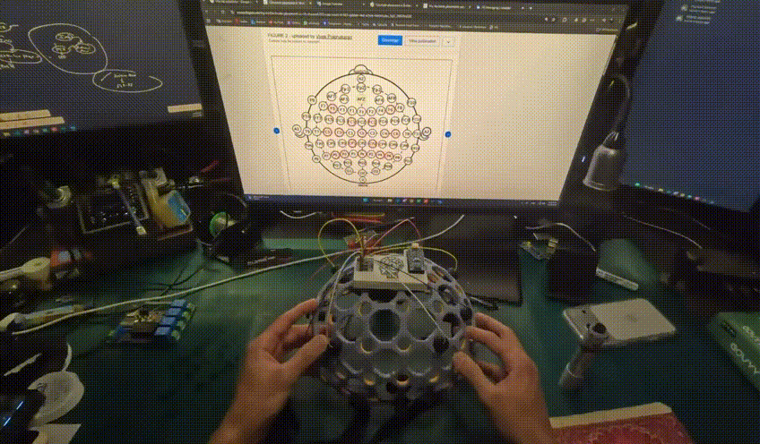 EEG Helmet project example